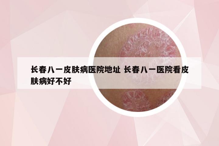 长春八一皮肤病医院地址 长春八一医院看皮肤病好不好