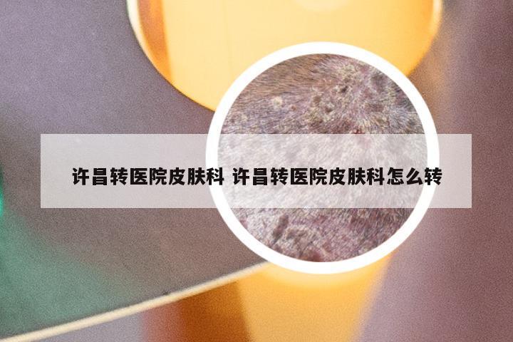 许昌转医院皮肤科 许昌转医院皮肤科怎么转