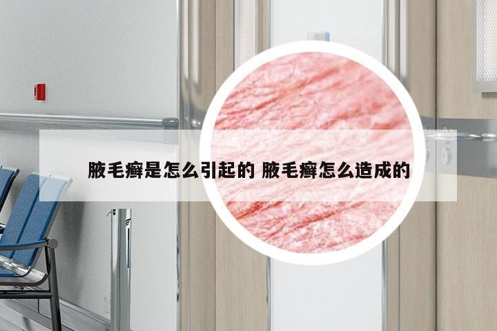 腋毛癣是怎么引起的 腋毛癣怎么造成的