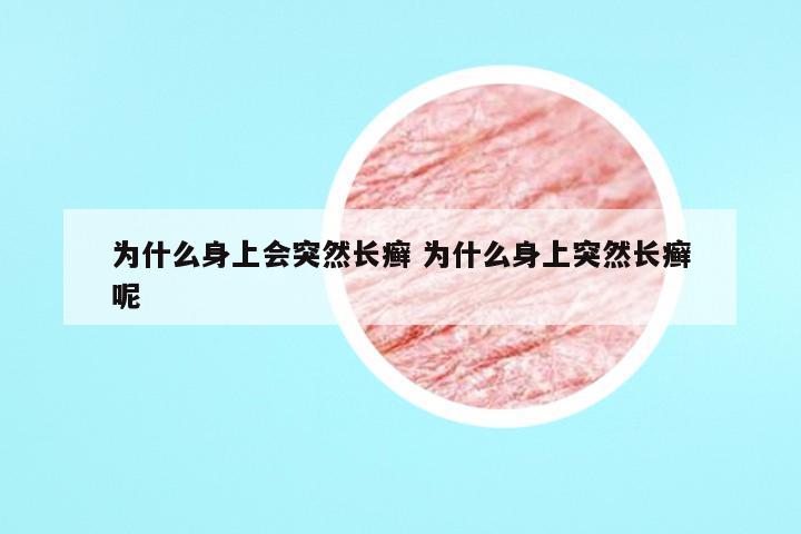 为什么身上会突然长癣 为什么身上突然长癣呢