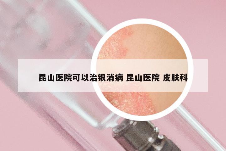 昆山医院可以治银消病 昆山医院 皮肤科