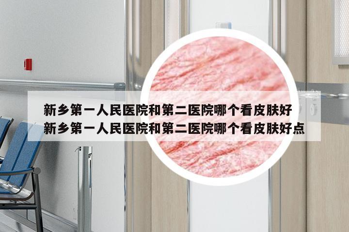新乡第一人民医院和第二医院哪个看皮肤好 新乡第一人民医院和第二医院哪个看皮肤好点
