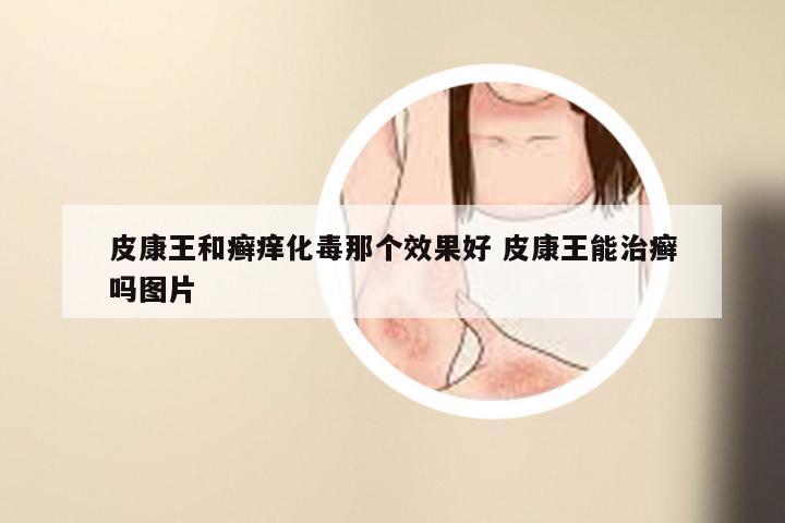 皮康王和癣痒化毒那个效果好 皮康王能治癣吗图片