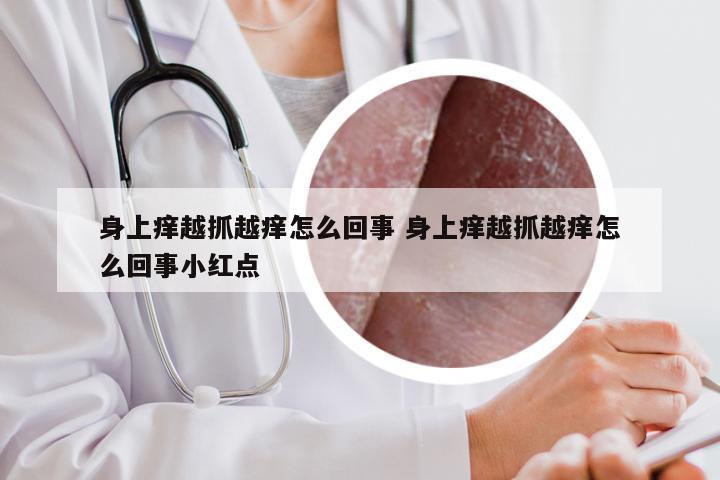 身上痒越抓越痒怎么回事 身上痒越抓越痒怎么回事小红点