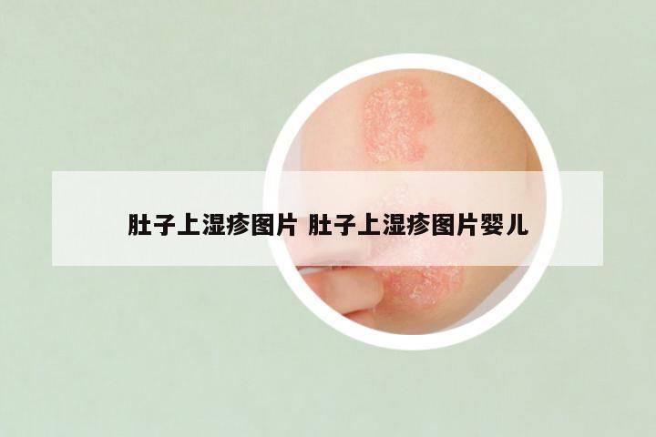 肚子上湿疹图片 肚子上湿疹图片婴儿