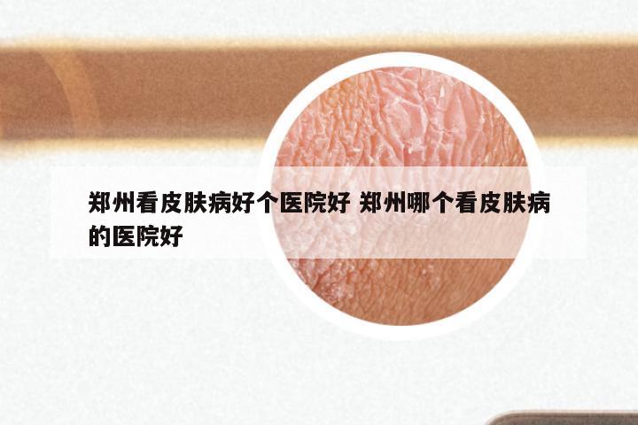 郑州看皮肤病好个医院好 郑州哪个看皮肤病的医院好
