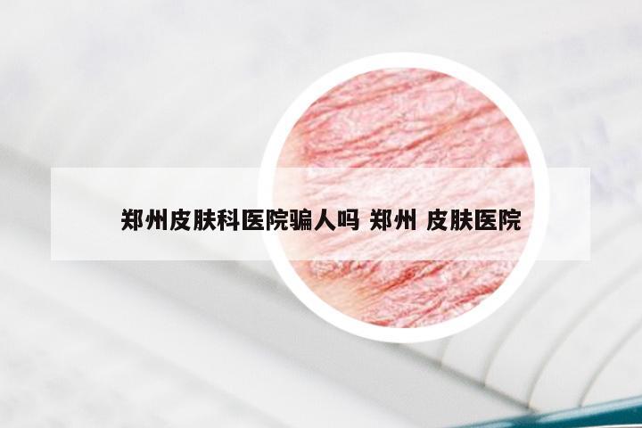 郑州皮肤科医院骗人吗 郑州 皮肤医院