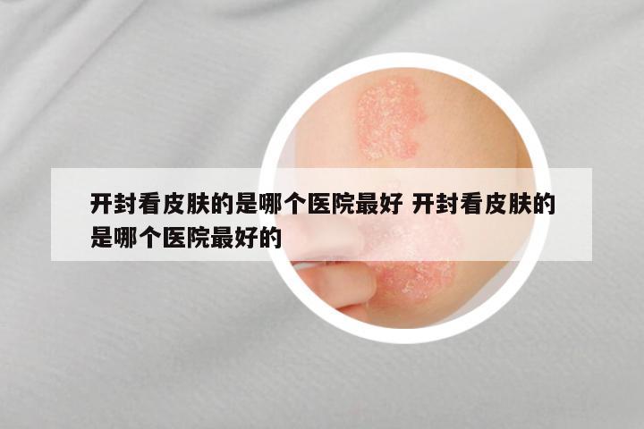 开封看皮肤的是哪个医院最好 开封看皮肤的是哪个医院最好的