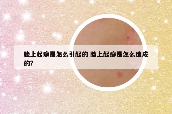 脸上起癣是怎么引起的 脸上起癣是怎么造成的?