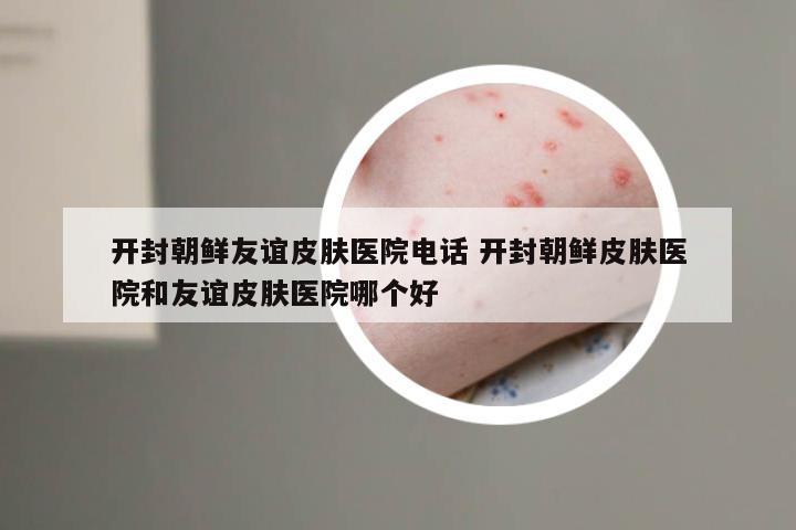 开封朝鲜友谊皮肤医院电话 开封朝鲜皮肤医院和友谊皮肤医院哪个好