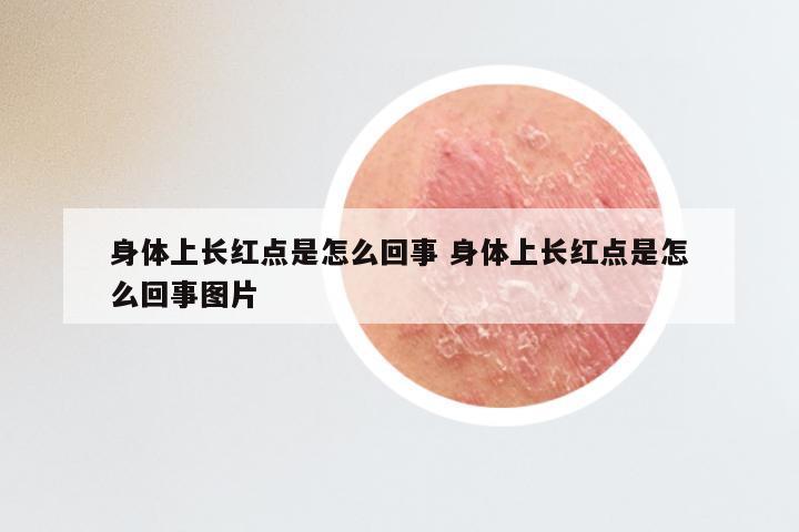 身体上长红点是怎么回事 身体上长红点是怎么回事图片
