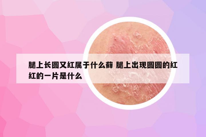 腿上长圆又红属于什么藓 腿上出现圆圆的红红的一片是什么