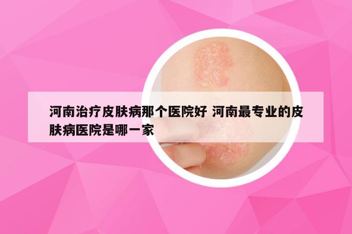 河南治疗皮肤病那个医院好 河南最专业的皮肤病医院是哪一家