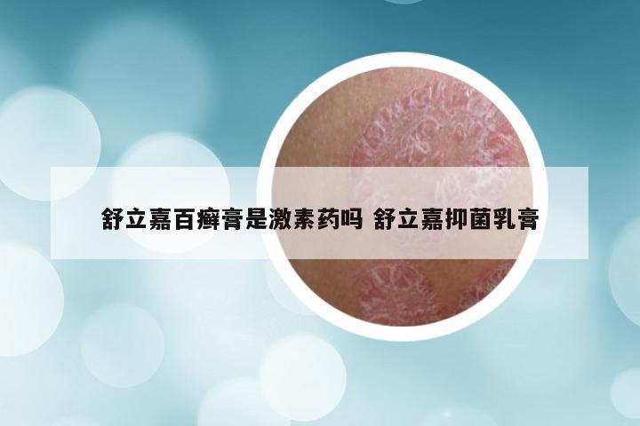 舒立嘉百癣膏是激素药吗 舒立嘉抑菌乳膏