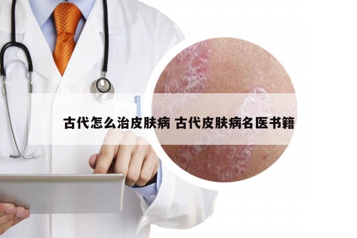 古代怎么治皮肤病 古代皮肤病名医书籍