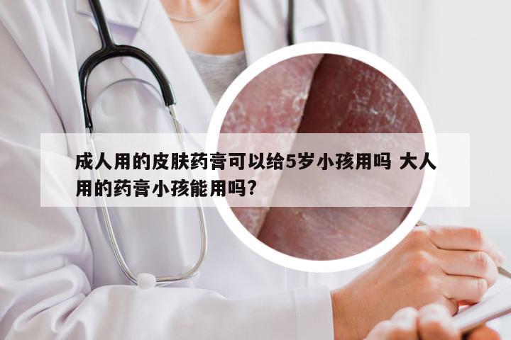 成人用的皮肤药膏可以给5岁小孩用吗 大人用的药膏小孩能用吗?