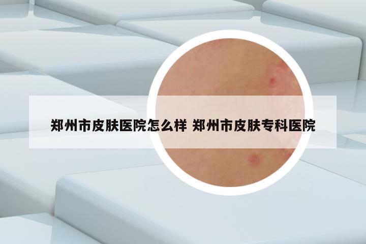 郑州市皮肤医院怎么样 郑州市皮肤专科医院
