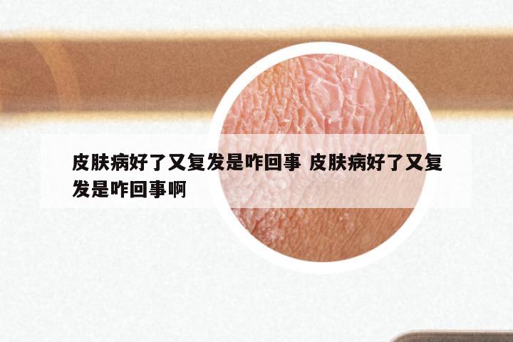 皮肤病好了又复发是咋回事 皮肤病好了又复发是咋回事啊