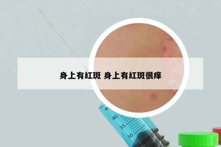 身上有红斑 身上有红斑很痒