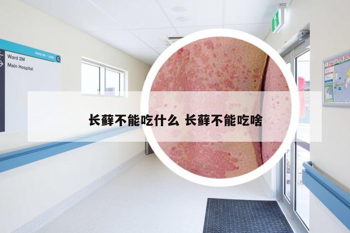 长藓不能吃什么 长藓不能吃啥