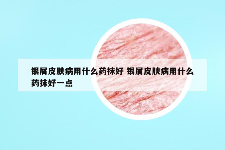 银屑皮肤病用什么药抹好 银屑皮肤病用什么药抹好一点