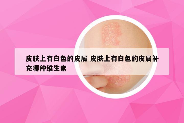 皮肤上有白色的皮屑 皮肤上有白色的皮屑补充哪种维生素