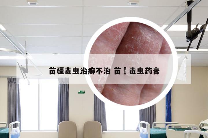 苗疆毒虫治癣不治 苗彊毒虫药膏