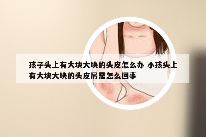 孩子头上有大块大块的头皮怎么办 小孩头上有大块大块的头皮屑是怎么回事