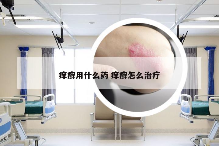 痒癣用什么药 痒癣怎么治疗