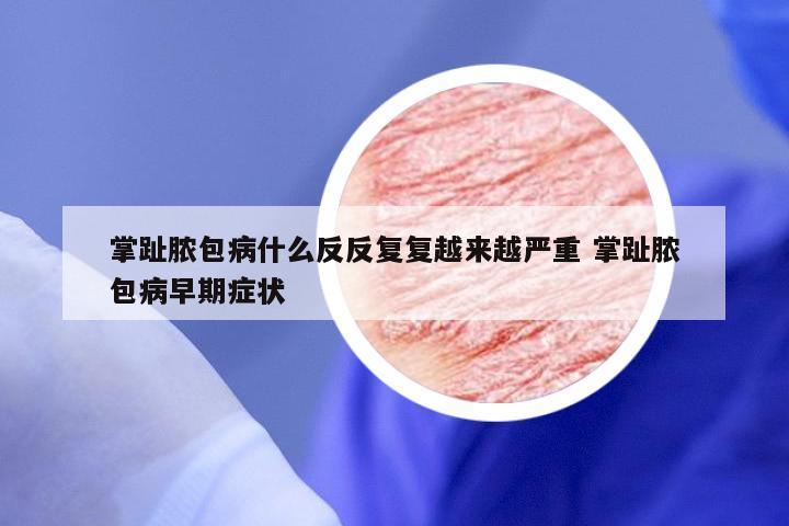 掌趾脓包病什么反反复复越来越严重 掌趾脓包病早期症状