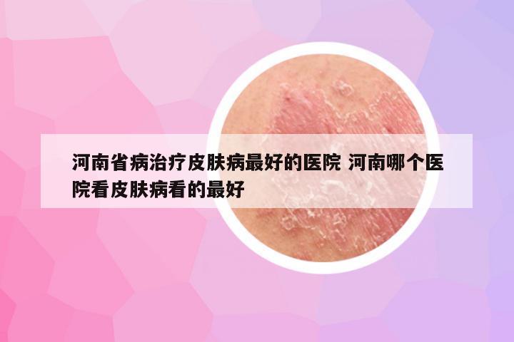 河南省病治疗皮肤病最好的医院 河南哪个医院看皮肤病看的最好