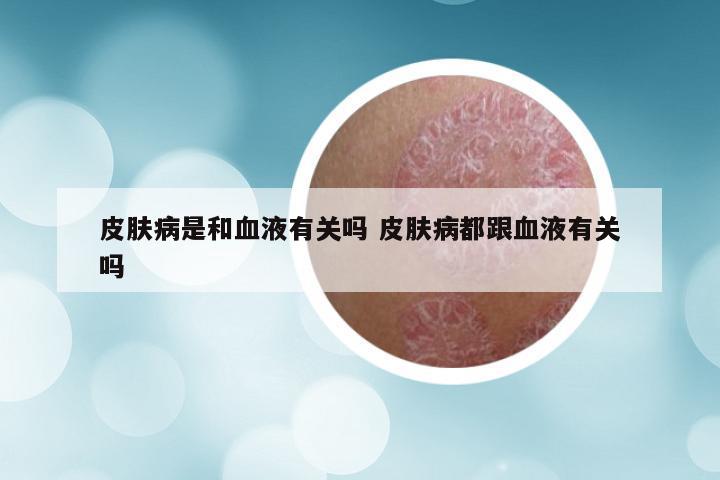 皮肤病是和血液有关吗 皮肤病都跟血液有关吗