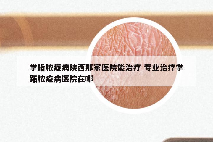 掌指脓疱病陕西那家医院能治疗 专业治疗掌跖脓疱病医院在哪