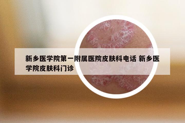 新乡医学院第一附属医院皮肤科电话 新乡医学院皮肤科门诊