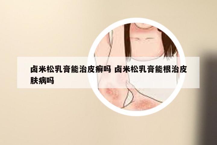 卤米松乳膏能治皮癣吗 卤米松乳膏能根治皮肤病吗