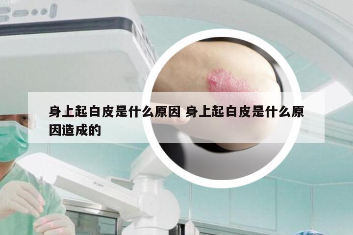 身上起白皮是什么原因 身上起白皮是什么原因造成的