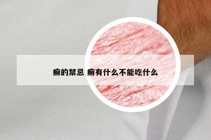 癣的禁忌 癣有什么不能吃什么