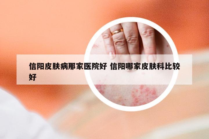 信阳皮肤病那家医院好 信阳哪家皮肤科比较好