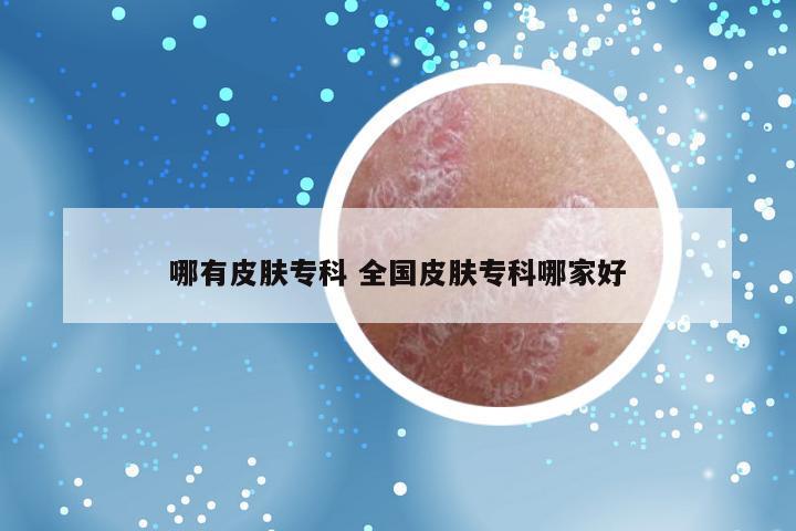 哪有皮肤专科 全国皮肤专科哪家好