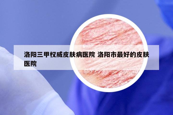 洛阳三甲权威皮肤病医院 洛阳市最好的皮肤医院