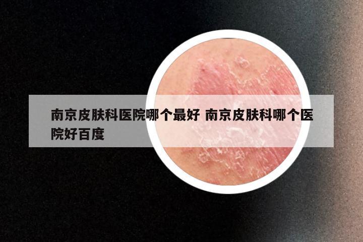 南京皮肤科医院哪个最好 南京皮肤科哪个医院好百度