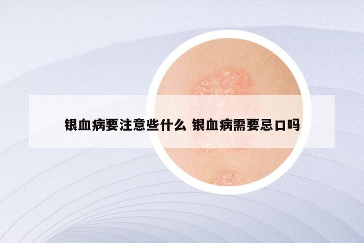 银血病要注意些什么 银血病需要忌口吗