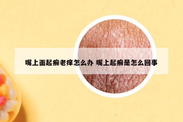 嘴上面起癣老痒怎么办 嘴上起癣是怎么回事