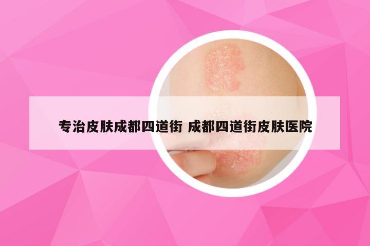 专治皮肤成都四道街 成都四道街皮肤医院