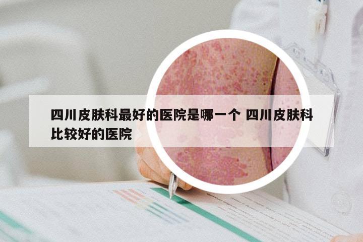 四川皮肤科最好的医院是哪一个 四川皮肤科比较好的医院