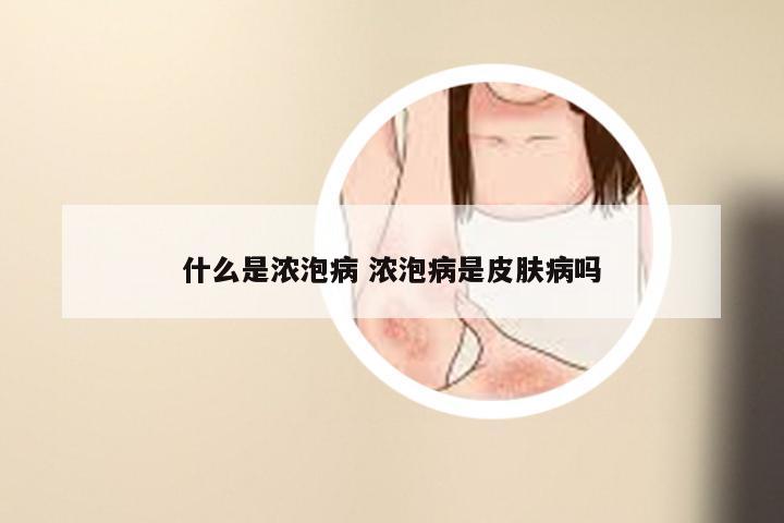 什么是浓泡病 浓泡病是皮肤病吗