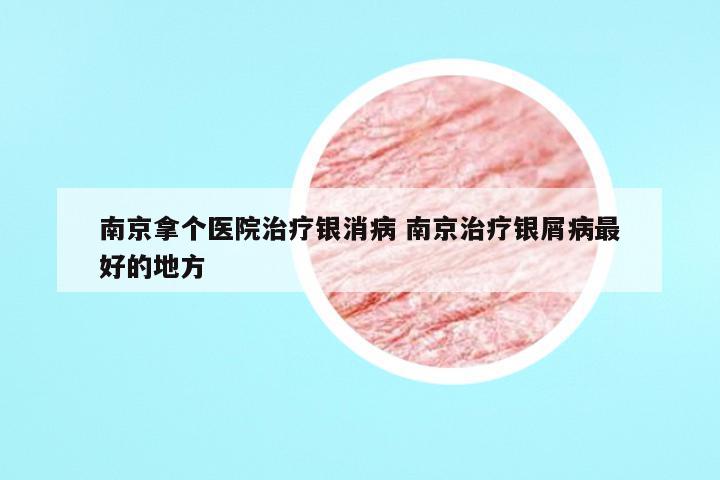 南京拿个医院治疗银消病 南京治疗银屑病最好的地方