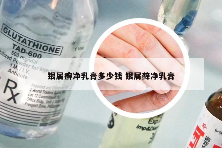 银屑癣净乳膏多少钱 银屑藓净乳膏