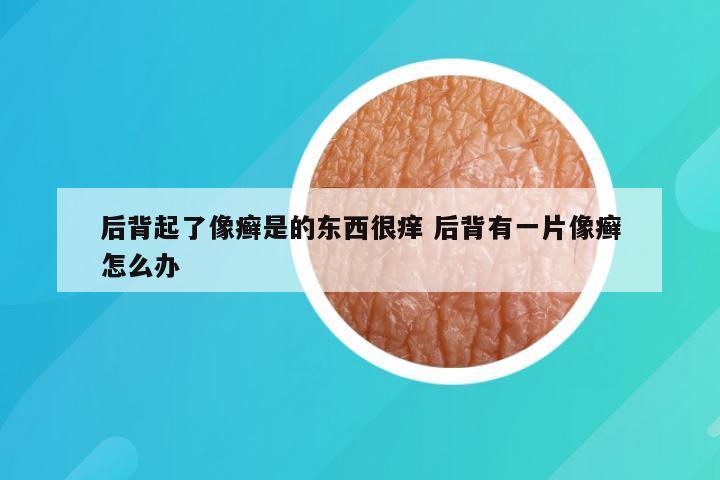 后背起了像癣是的东西很痒 后背有一片像癣怎么办