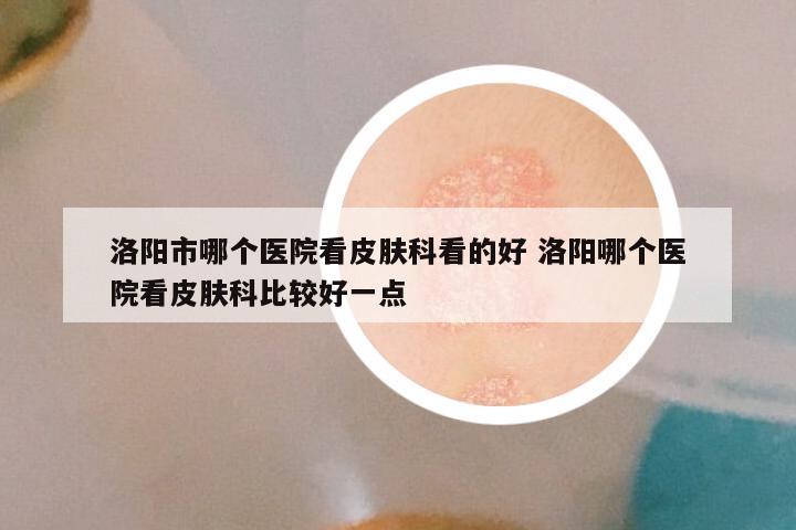洛阳市哪个医院看皮肤科看的好 洛阳哪个医院看皮肤科比较好一点